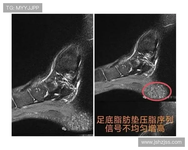 足球明星在比赛中频频晕倒的原因探讨及其对运动健康的影响分析